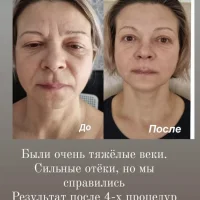 центр омоложения и йоги new me изображение 4