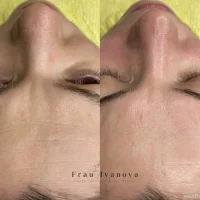 центр омоложения и йоги new me изображение 10